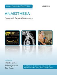 Produktbild: Challenging Concepts in Anaesthesia