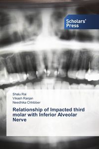 Produktbild: Relationship of Impacted third molar with Inferior Alveolar Nerve