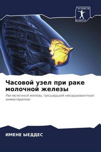 Produktbild: Chasowoj uzel pri rake molochnoj zhelezy