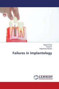 Produktbild: Failures in Implantology