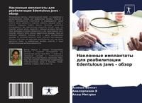 Produktbild: Naklonnye implantaty dlq reabilitacii Edentulous Jaws - obzor