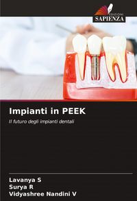 Produktbild: Impianti in PEEK