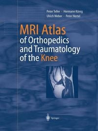 Produktbild: MRI Atlas of Orthopedics and Traumatology of the Knee