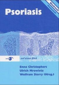 Produktbild: Psoriasis auf einen Blick 3894125470