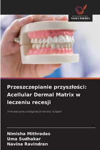 Produktbild: Przeszczepianie przysz&iquest;o&iquest;ci: Acellular Dermal Matrix w leczeniu recesji