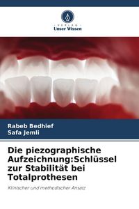 Produktbild: Die piezographische Aufzeichnung:Schl&uuml;ssel zur Stabilit&auml;t bei Totalprothesen