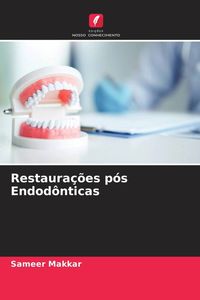 Produktbild: Restaura&ccedil;&otilde;es p&oacute;s Endod&ocirc;nticas