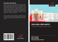 Produktbild: Okluzja Implantu