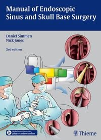Produktbild: Manual of Endoscopic Sinus and Skull Base Surgery