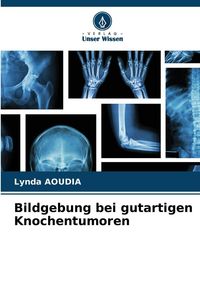 Produktbild: Bildgebung bei gutartigen Knochentumoren