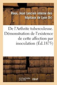Produktbild: De l'Arthrite tuberculeuse. D&eacute;monstration de l'existence de cette affection par inoculation