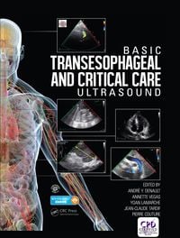 Produktbild: Basic Transesophageal and Critical Care Ultrasound