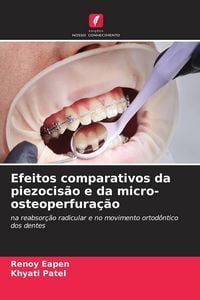 Produktbild: Efeitos comparativos da piezocis&atilde;o e da micro-osteoperfura&ccedil;&atilde;o