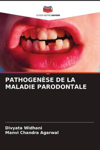 Produktbild: Pathogen&egrave;se De La Maladie Parodontale