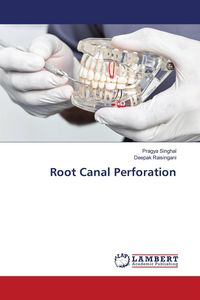 Produktbild: Root Canal Perforation