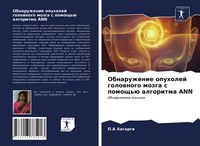 Produktbild: Obnaruzhenie opuholej golownogo mozga s pomosch'&uuml; algoritma ANN