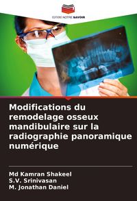Produktbild: Modifications du remodelage osseux mandibulaire sur la radiographie panoramique num&eacute;rique