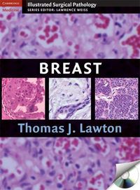 Produktbild: Illustrated Surgical Pathology of the Breast