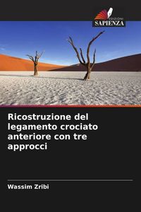 Produktbild: Ricostruzione del legamento crociato anteriore con tre approcci