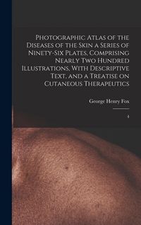 Produktbild: Photographic Atlas of the Diseases of the Skin a Series of Ninety-six Plates, Comprising Nearly two Hundred Illustrations, With Descriptive Text, and