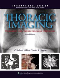 Produktbild: Webb, W: Thoracic Imaging