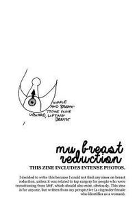 Produktbild: My Breast Reduction