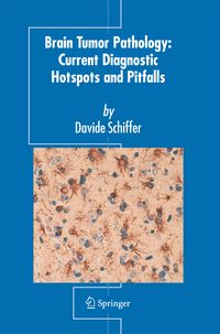 Produktbild: Brain Tumor Pathology: Current Diagnostic Hotspots and Pitfalls