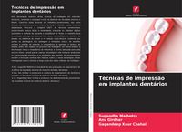Produktbild: T&eacute;cnicas de impress&atilde;o em implantes dent&aacute;rios