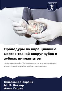 Produktbild: Procedury po naraschiwani&uuml; mqgkih tkanej wokrug zubow i zubnyh implantatow