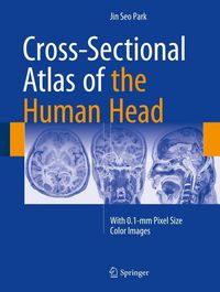 Produktbild: Cross-Sectional Atlas of the Human Head