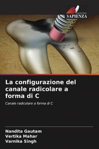 Produktbild: La configurazione del canale radicolare a forma di C