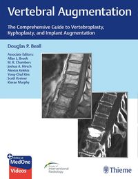 Produktbild: Vertebral Augmentation