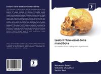 Produktbild: Lesioni fibro-ossei della mandibola