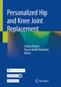 Produktbild: Personalized Hip and Knee Joint Replacement