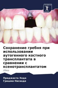 Produktbild: Sohranenie grebnq pri ispol'zowanii autogennogo kostnogo transplantata w srawnenii s xenotransplantatom