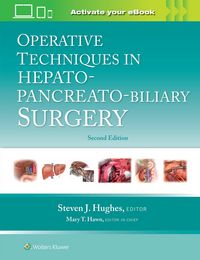 Produktbild: Operative Techniques in Hepato-Pancreato-Biliary Surgery