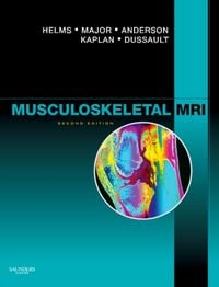 Produktbild: Musculoskeletal MRI