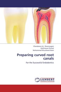 Produktbild: Preparing curved root canals