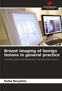 Produktbild: Breast imaging of benign lesions in general practice