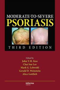 Produktbild: Moderate-To-Severe Psoriasis