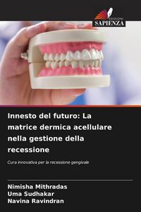 Produktbild: Innesto del futuro: La matrice dermica acellulare nella gestione della recessione