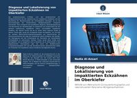 Produktbild: Diagnose und Lokalisierung von impaktierten Eckz&auml;hnen im Oberkiefer