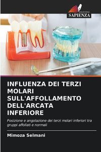 Produktbild: INFLUENZA DEI TERZI MOLARI SULL'AFFOLLAMENTO DELL'ARCATA INFERIORE