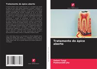 Produktbild: Tratamento do &aacute;pice aberto