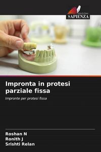 Produktbild: Impronta in protesi parziale fissa