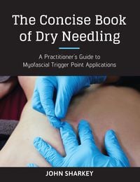 Produktbild: The Concise Book of Dry Needling