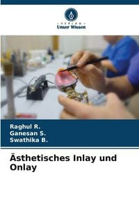 Produktbild: &Auml;sthetisches Inlay und Onlay