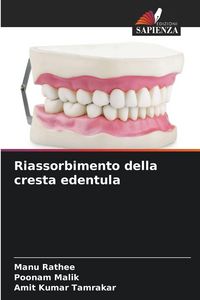 Produktbild: Riassorbimento della cresta edentula