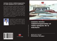 Produktbild: L&eacute;sions mixtes radiotransparentes et radio-opaques de la m&acirc;choire