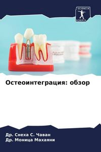 Produktbild: Osteointegraciq: obzor